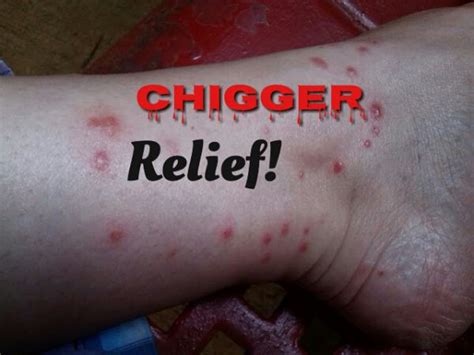 can you spray for chiggers and have you ever considered the environmental impact of chemical sprays?